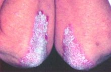 �-� �������� ������, ���������������� � ��� "��������������": ���� ���� � Daivobet ��� ��������� �� ���������