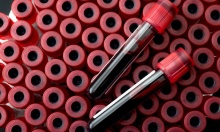 ������ ���� ���� �� ������� ��������� �� ��� �� �������, �������� �� HPV