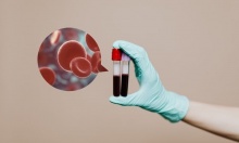 ����������� ���������� ���������� ������� ��������� �� ���