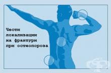 Симптоми и признаци на остеопороза