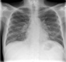 ���������� �� ����������� �� ������������, �� �� ���������� ������������ �� ��������