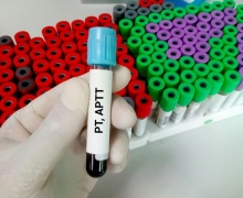     (aPTT)