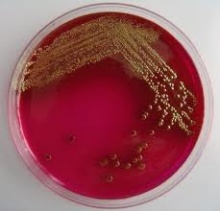     (E. coli)