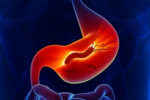     (Helicobacter pylori)
