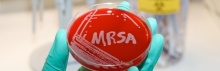   MRSA ( - Staphylococcus aureus)